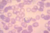mature gametocyte.jpg (18384 bytes)