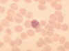 microgametocyte.jpg (11843 bytes)